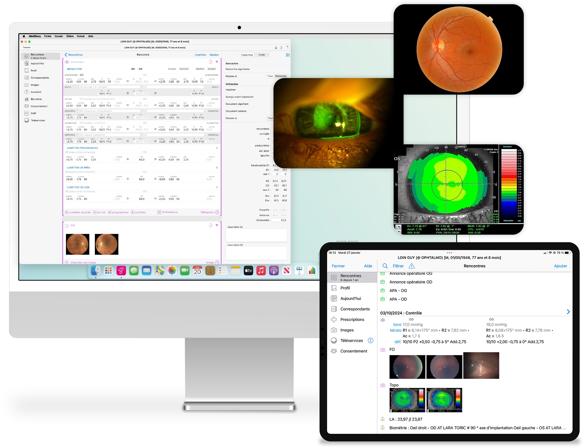 Vues de l'application MediStory pour les ophtalmologues